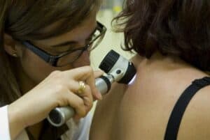 Dia do Euromelanoma. Hospital de Braga regista 35 casos